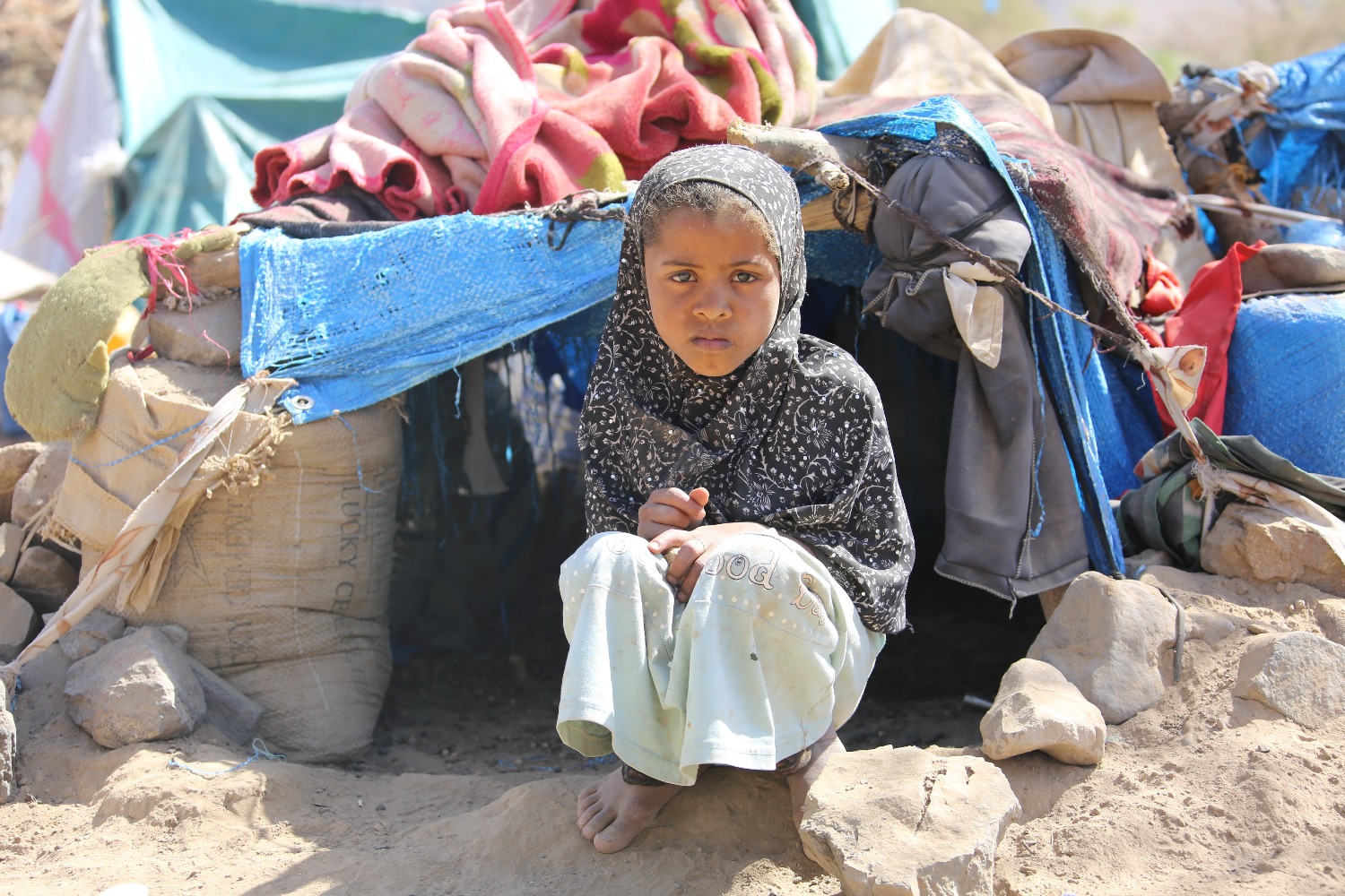 В ООН обеспокоены: в Йемене эпидемия холеры и опасность возобновления войны